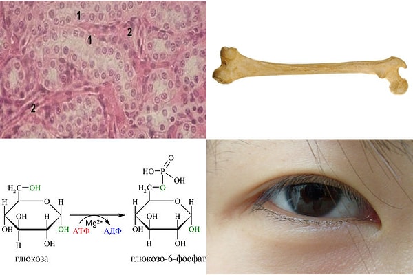 7. Эпиканта - это...