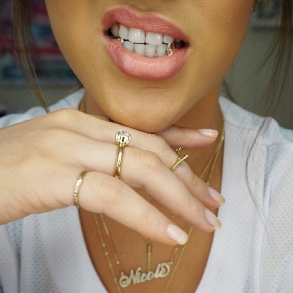 15. Постоянные крепятся при помощи болтов и могут испортить прикус