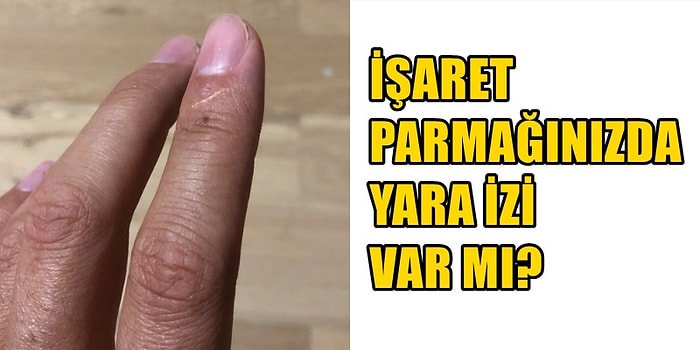 Çok Küçük İstisnalar Olsa Dahi İnsanların %99'unda Görünen 6 Vücut Tuhaflığı