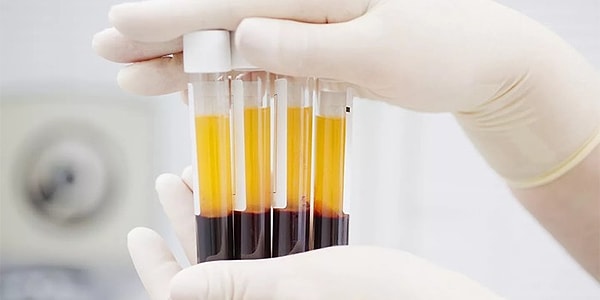 9. Как называется жидкая часть крови?