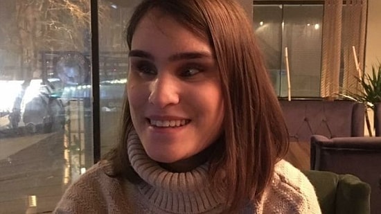 Bunu da Gördük: Görme Engelli Öğretmen 'Kusura Bakmayın, Hata Yapmışız' Denilerek Telefonla Görevden Alındı