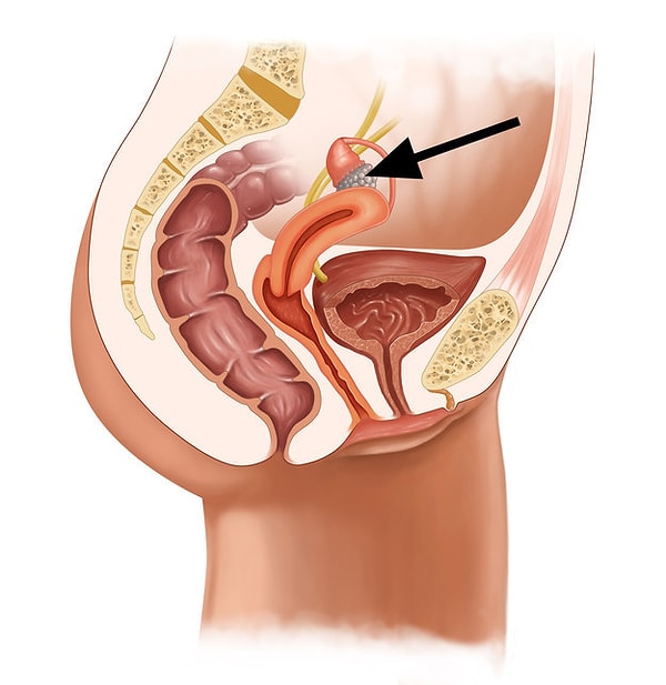 6. Теперь рассмотрим женскую. Как называется этот орган?