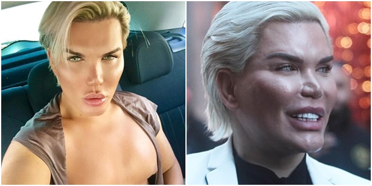 Ken Bebek Olarak Taninan Rodrigo Alves In Son Hali Gorenleri Saskina Cevirdi Onedio Com