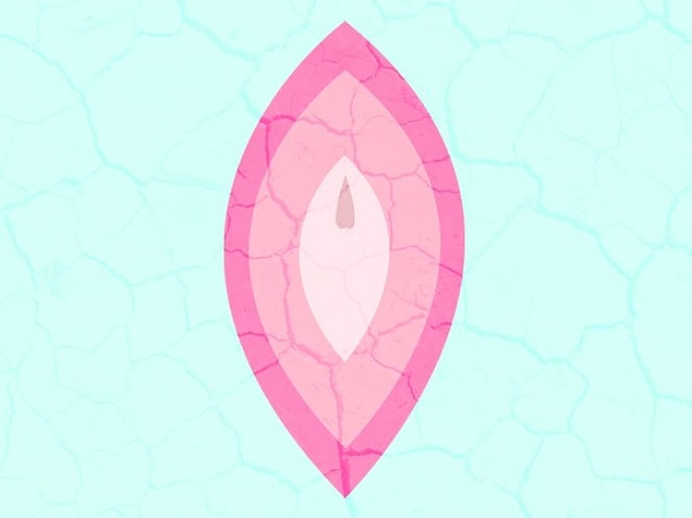 10. Vajinal kuruluk