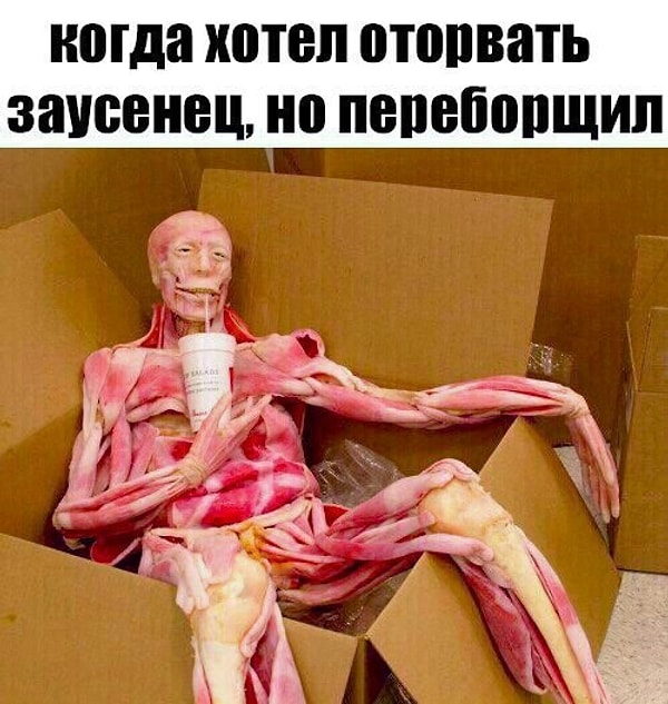 14. А больной заусенец, который ты не трогаешь, терпя до последнего, а потом вырываешь с мясом?