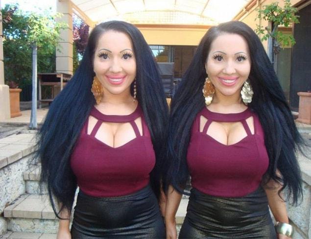 1. If your identical twin got plastic surgery, it would be hard not to feel a little insulted.