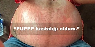 Hamileliği İyisi, Kötüsü ve Çirkini ile Özetlediği için Her Annenin Kendinden Bir Şey Bulacağı 23 Kare