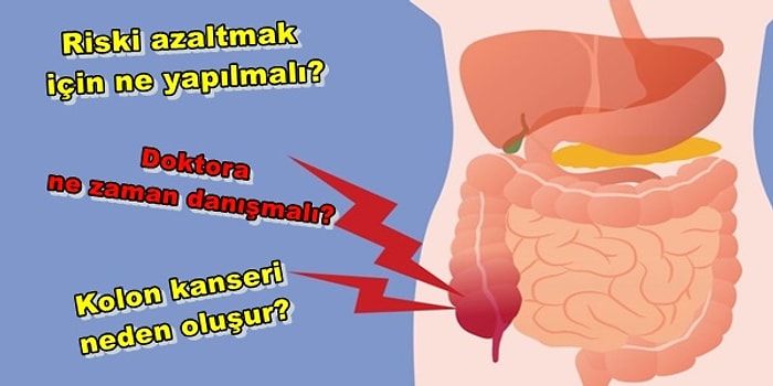 Kolon Kanseri Hakkında En Çok Merak Edilen Sorular ve Cevapları