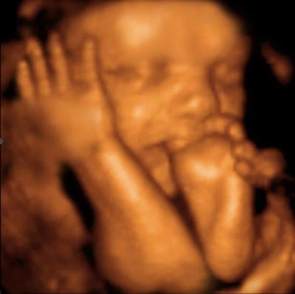 26. "Да. Аллё! Это малыш..."