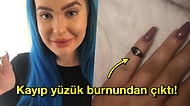 Hık Demiş Burnundan Düşmüş! Yıllardır Kayıp Olan Yüzüğü Burnundan Çıkan Kadın