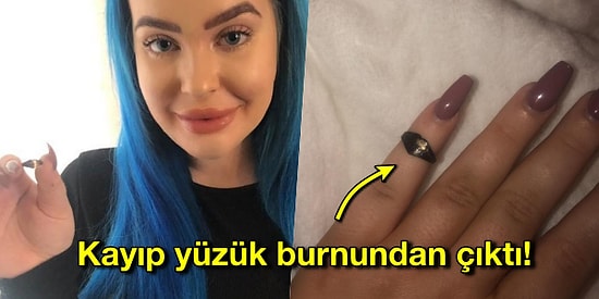 Hık Demiş Burnundan Düşmüş! Yıllardır Kayıp Olan Yüzüğü Burnundan Çıkan Kadın