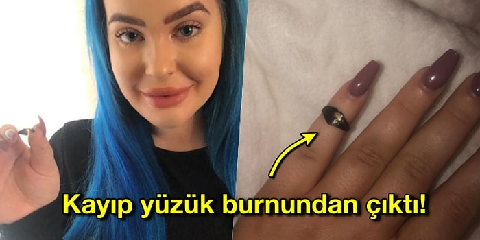 Hık Demiş Burnundan Düşmüş! Yıllardır Kayıp Olan Yüzüğü Burnundan Çıkan Kadın