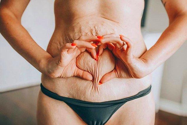 Kanadalı 34 yaşındaki anne, vücutlarını sevmeleri konusunda diğer kadınlara ilham vermek istiyor.