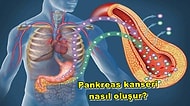 Pankreas Kanseri ile İlgili En Çok Merak Edilen Sorular ve Cevapları