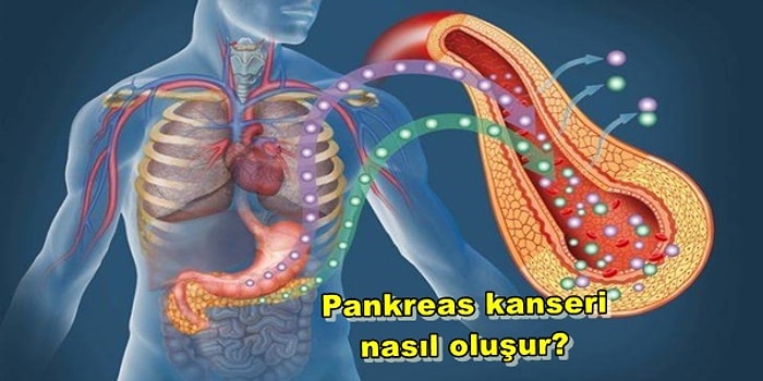 Pankreas Kanseri ile İlgili En Çok Merak Edilen Sorular ve Cevapları