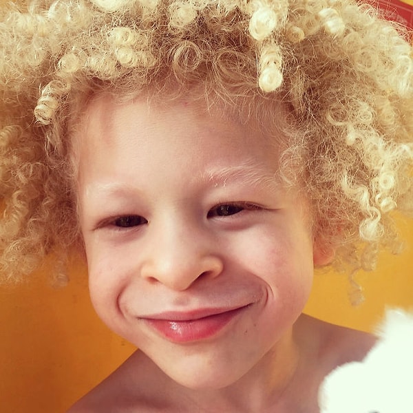 14. На своем примере женщина доказала, что не нужно стесняться того, что ваш ребенок непохож на других