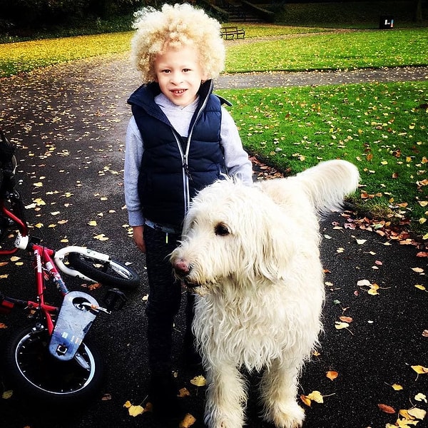 3. Родители не были готовы к такой ситуации, и многие вопросы касательно воспитания ребенка-альбиноса пришлось узнавать у врачей