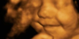 4 Boyutlu Tarayıcı ile Görüntülenen Anne Karnındaki Bebeğin Muhteşem Anları