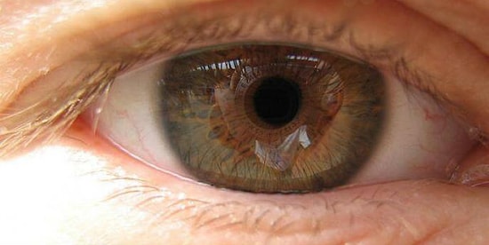 Aman Dikkat! Sıkça Rastlanan Göz Rahatsızlığı Makula Dejenerasyonu Hakkında Mutlaka Bilmeniz Gerekenler