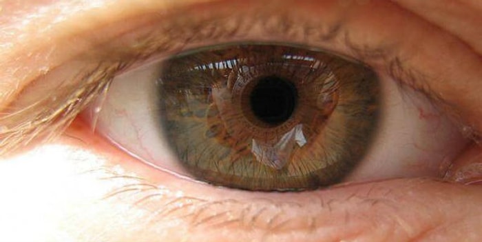 Aman Dikkat! Sıkça Rastlanan Göz Rahatsızlığı Makula Dejenerasyonu Hakkında Mutlaka Bilmeniz Gerekenler