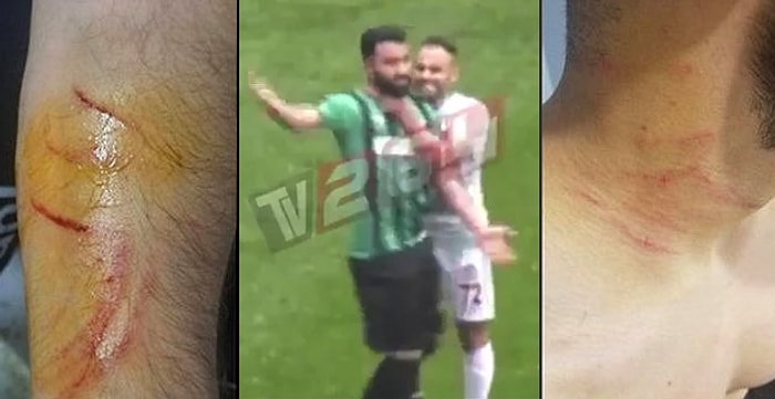 4 Futbolcunun Şikâyeti Üzerine Soruşturma Başlatılmıştı: Amedsporlu Mansur Çalar Adli Kontrol Şartıyla Serbest