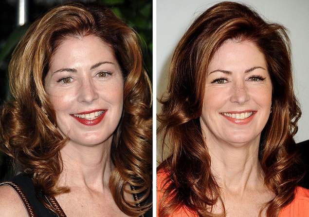 18. Dana Delany
