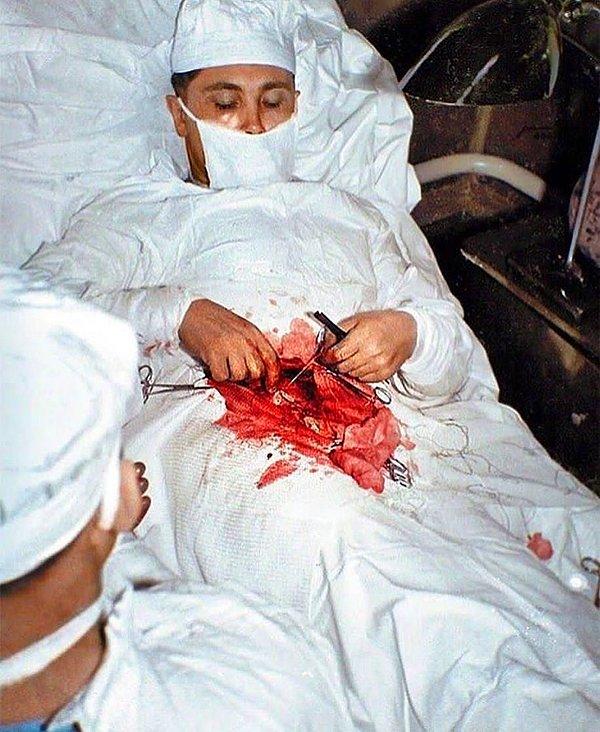 15. Kendi apandisit ameliyatını kendi elleriyle yapan cerrah Leonid Rogozov.