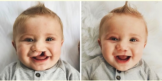 Tıp Dünyasından Sizi Hayrete Düşürecek 17 Enteresan Kare