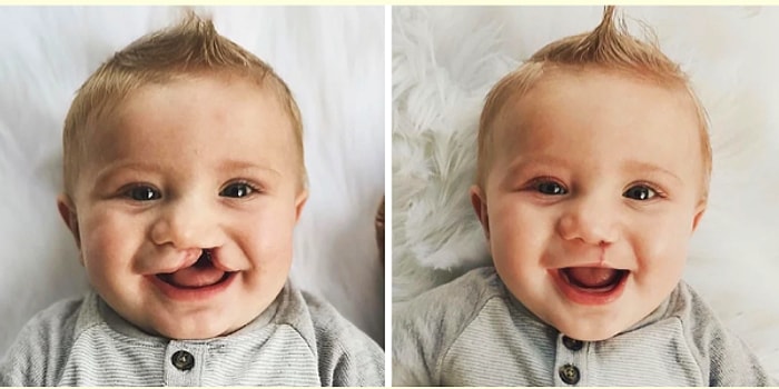 Tıp Dünyasından Sizi Hayrete Düşürecek 17 Enteresan Kare