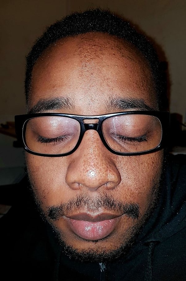 19. "У моего парня веснушки только на одной половине лица"