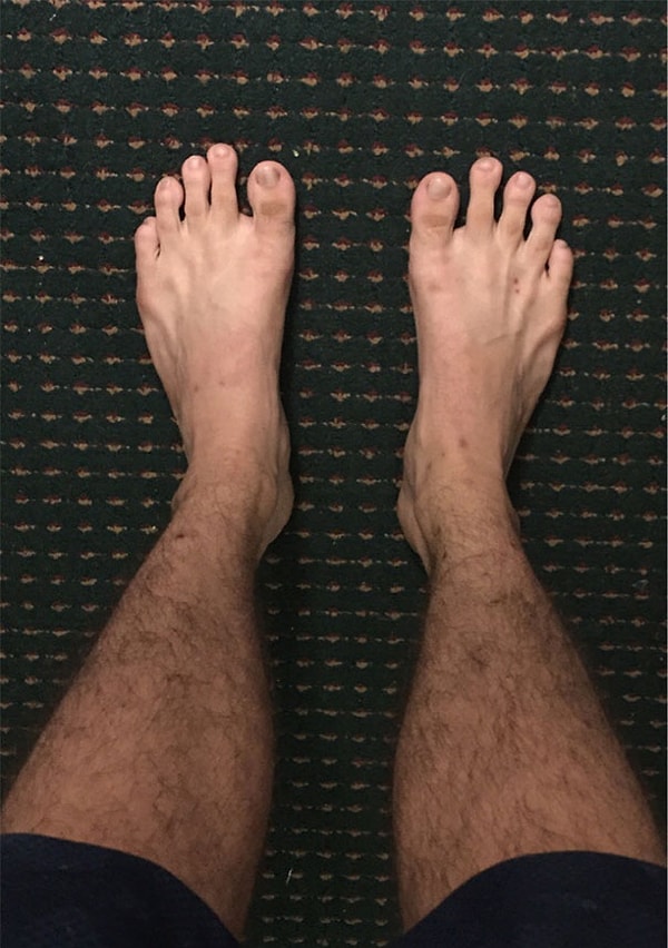 22. Когда большие пальцы меньше всех других