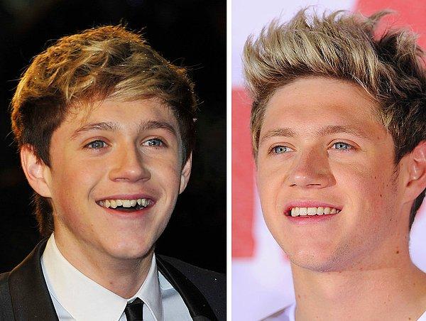 12. Niall Horan, dişleri yüzünden az kalsın One Direction grubuna alınmayacaktı. O da saçlarını boyattı, uzun süren tel tedavisi ile istediği dişlere kavuştu.
