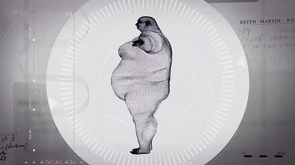 Doktorlar, vücut kitle indeksi 155 olan adamın kilo vermediği sürece en fazla iki yıl daha yaşayacağını söylediler.