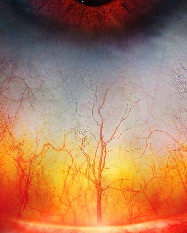 13. Bir insanın gözündeki, lanetli bir ormanı andıran damarlar.
