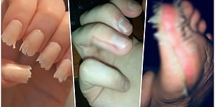 İddia Ediyoruz, Öğürmeden Bu İçeriği Tamamlayamayacaksınız! Dünyanın En İç Kaldırıcı 17 Fotoğrafı