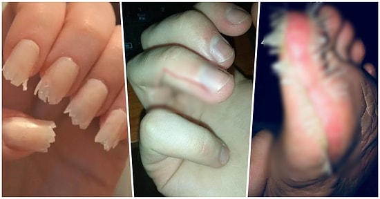 İddia Ediyoruz, Öğürmeden Bu İçeriği Tamamlayamayacaksınız! Dünyanın En İç Kaldırıcı 17 Fotoğrafı