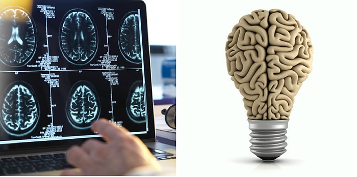 Если пройдёте тест на знание мозга человека на 14/14, то можете считать себя настоящим профессором