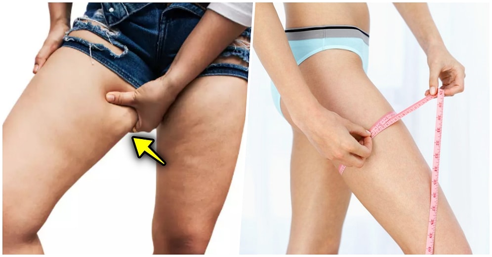 Yaz Geliyor Yaz! Kurtulmak İçin Her Yolun Denendiği, İç Bacaklardaki Sarkan Yağları Eritecek Egzersizler