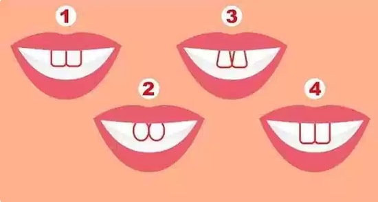 Тест: Форма ваших зубов может рассказать о вас кое-что интересное