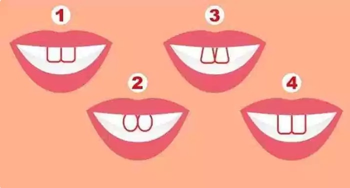 Тест: Форма ваших зубов может рассказать о вас кое-что интересное