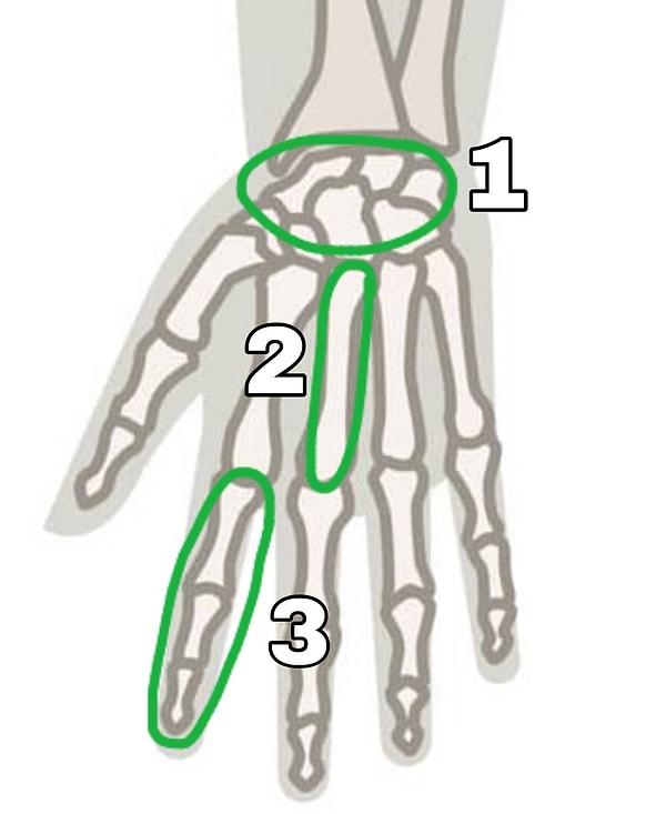 7. А где расположены фаланги?