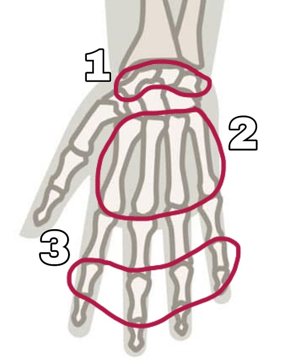 10. И последнее: где у нас пястные кости?