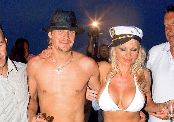 3. Pamela Anderson ve Kid Rock (2006):