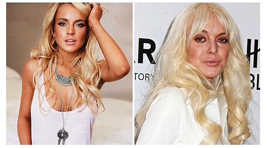 Dimyat'a Pirince Giderken Evdeki Bulgurdan Olan Estetik Operasyon Mağduru 25 Ünlü İsim