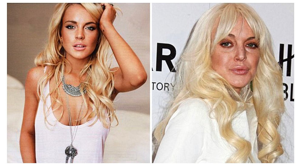 Dimyat'a Pirince Giderken Evdeki Bulgurdan Olan Estetik Operasyon Mağduru 25 Ünlü İsim