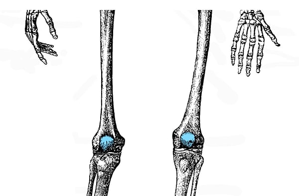 6. Что это за кость?