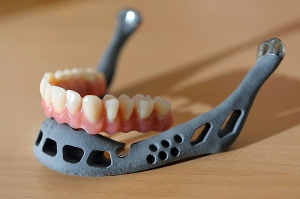 Dişler ve çene implantları insanların tamamen yeni bir görünüm kazanmalarına yardımcı olacak.