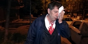 Gazeteci Yavuz Selim Demirağ Saldırıya Uğradı