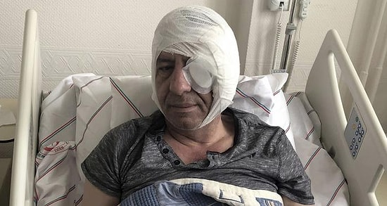 Gazeteci Demirağ'a Sopayla Saldıran 6 Kişi, 'Hayati Tehlike Bulunmadığı' Gerekçesiyle Serbest Bırakıldı