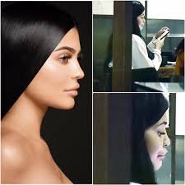 28. В реальности губа так и выглядит